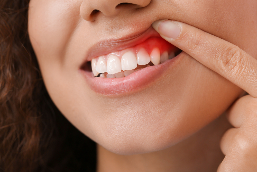 Trimble Dental | Dangers of Untreated Gum Disease: Diabetes and Heart Conditions Trimble Dental | Dangers of Untreated Gum Disease: Diabetes and Heart Conditions